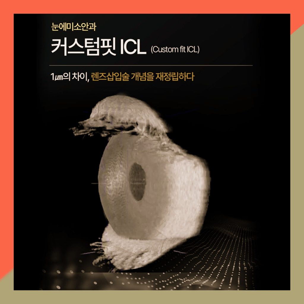 렌즈삽입술 썸네일 렌즈삽입술 썸네일