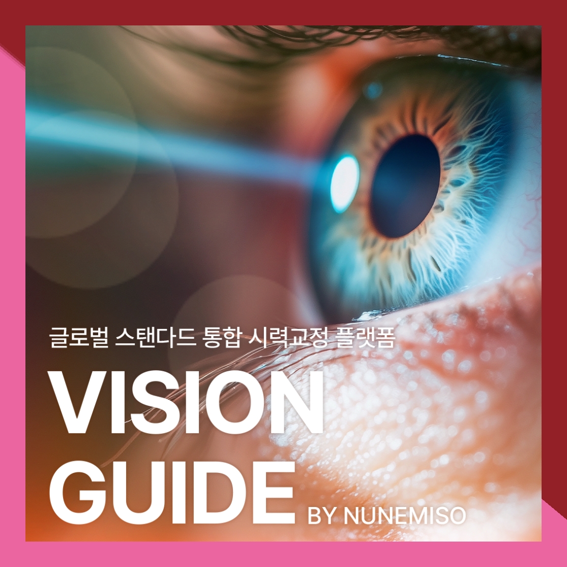 스마일라식 썸네일